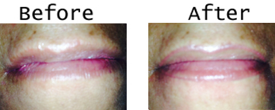 Permanent Makeup lips and liner San Diego